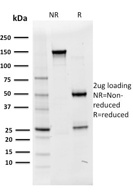 Data from SDS-PAGE analysis of Anti-Oct-2 antibody (Clone OCT2/2136). Reducing lane (R) shows heavy and light chain fragments. NR lane shows intact antibody with expected MW of approximately 150 kDa. The data are consistent with a high purity, intact mAb.